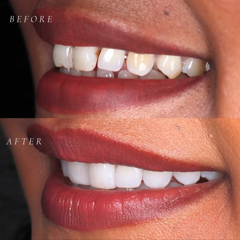 Precision Artistry