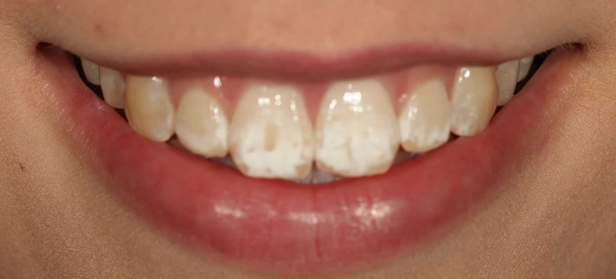 White Spots